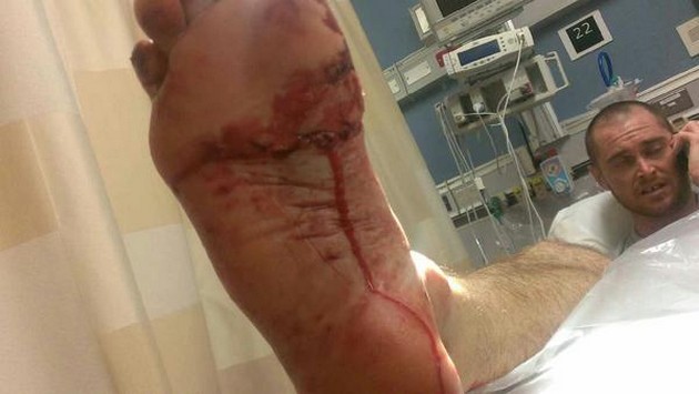 Hajbett skickar Brevard-mannen till sjukhus Cavalier & Blue Marlin Sport Fishing Gran Canaria